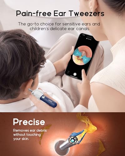 Bebird Earsight Plus R37R Ear Wax Removal Tool Camera, FSA HSA Eligible Items, Smart Ear Cleaner with Painless Visual Tweezers, Flexible Ear Camera Otoscope, Home ENT Cleaning Kit for Family,Blue - color: Blue