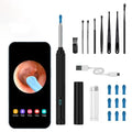 Ear Wax Removal Tool Camera, Wireless Ear Cleaner with 1080P Otoscope & LED Light, Visual Earwax Removal Kit with Soft Silicone Tips, Ear Camera for iOS & Android (Black) - color: Black