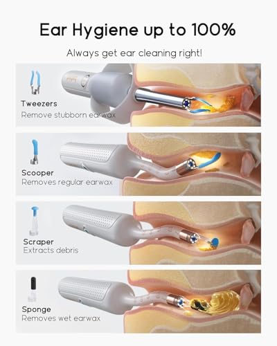 Bebird Earsight Plus R37R Ear Wax Removal Tool Camera, FSA HSA Eligible Items, Smart Ear Cleaner with Painless Visual Tweezers, Flexible Ear Camera Otoscope, Home ENT Cleaning Kit for Family,White - color: White