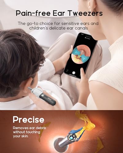 Bebird Earsight Plus R37R Ear Wax Removal Tool Camera, FSA HSA Eligible Items, Smart Ear Cleaner with Painless Visual Tweezers, Flexible Ear Camera Otoscope, Home ENT Cleaning Kit for Family,Black - color: Black