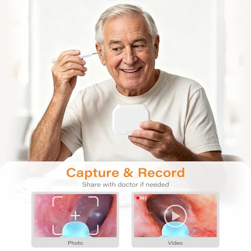 Ear Wax Removal Tool Camera with Screen, Smart Screen Ear Wax Removal Kit with 2.8'' HD Display, WiFi Automatic Connect - Ear Cleaner Tool with Camera&Screen, 6 Replaceable Tips, No App/Phone Needed