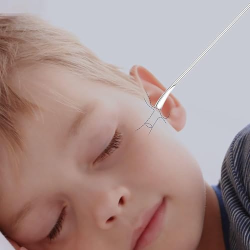 6 Pcs Ear Wax Removal Kit,Ear Cleaner: Speetop Mini Portable Ear Pick | Ear Scope with Stainless Steel 360° Spiral Ear Massage Cleaning Tool for Adults Kids - Ear Wax Remover with Storage Box - color: Yellow