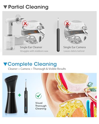 Ear Cleaner with Camera & Irrigation. Wax Removal & Overheat Protect | Complete Ear Cleaning Kit, Visual, Waste Collection Tank, Overheat Auto-Shutoff, IPX7 Waterproof, FSA-HSA Ear Wax Removal - color: Jet Black