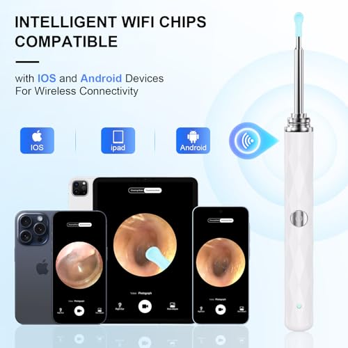 High-Definition Ear Wax Removal, Wireless Ear Cleaner, Safe and Gentle Ear Wax Removal Kit, Rechargeable Ear Cleaner with Camera and Light, Ear Cleaning Kit for Android and iOS (White) - color: White