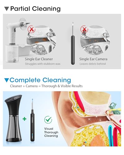 Ear Cleaner with Camera & Irrigation. Wax Removal & Overheat Protect | Complete Ear Cleaning Kit, Visual, Waste Collection Tank, Overheat Auto-Shutoff, IPX7 Waterproof, FSA-HSA Ear Wax Removal - color: Semi-transparent Black