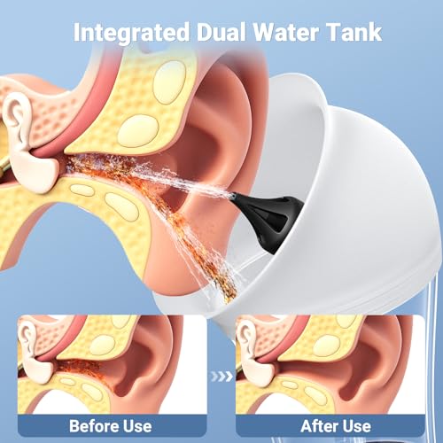 Electric Ear Cleaner with Water Temp Sensor, Ear Irrigation Flushing Kit | 4 Pressure Modes, One-Piece Tank, IPX6 Water Resistant, Ear Cleaning Kit, Earwax Removal Kit for Home Cleaning Checking - color: Blue