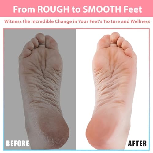 Efforest Shower Foot Scrubber Mat with Pumice Stone - Cleans, Smooths & Removes Dead Skin on Foot Without Bending, Foot Callus Remover with Non-Slip Suction Cups (Black) - color: Black
