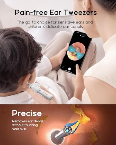 Bebird Earsight Plus R37R Ear Wax Removal Tool Camera, FSA HSA Eligible Items, Smart Ear Cleaner with Painless Visual Tweezers, Flexible Ear Camera Otoscope, Home ENT Cleaning Kit for Family,White - color: White