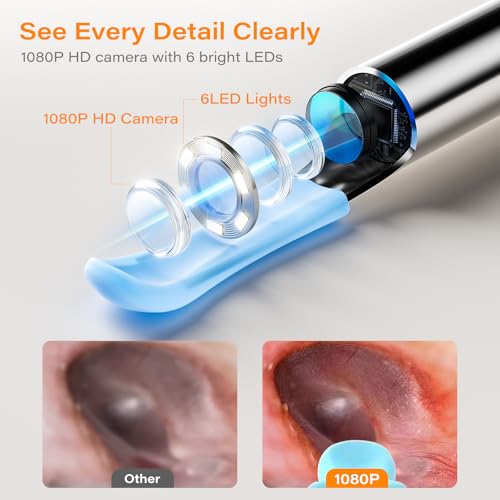 Ear Wax Removal Tool Camera with Screen, Smart Screen Ear Wax Removal Kit with 2.8'' HD Display, WiFi Automatic Connect - Ear Cleaner Tool with Camera&Screen, 6 Replaceable Tips, No App/Phone Needed