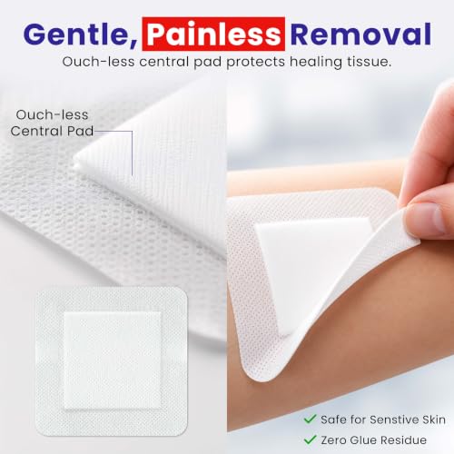 HEALQU Island Dressing - 4"x4", 30 Count - Bordered Gauze Sterile Individually Wrapped Gauze Pads, Water-Resistant, Non-Woven Backing - Soft and Breathable Wound Dressing for First Aid and Medical | Water-Resistant, Latex-Free, High Absorbent, Adhesive Bo