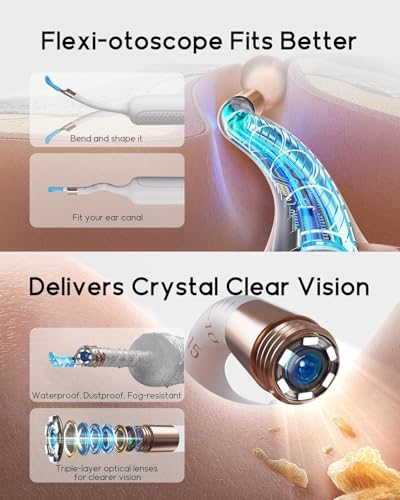 Bebird Earsight Plus R37R Ear Wax Removal Tool Camera, FSA HSA Eligible Items, Smart Ear Cleaner with Painless Visual Tweezers, Flexible Ear Camera Otoscope, Home ENT Cleaning Kit for Family,White - color: White