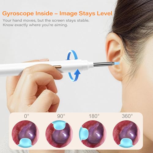 Ear Wax Removal Tool Camera with Screen, Smart Screen Ear Wax Removal Kit with 2.8'' HD Display, WiFi Automatic Connect - Ear Cleaner Tool with Camera&Screen, 6 Replaceable Tips, No App/Phone Needed