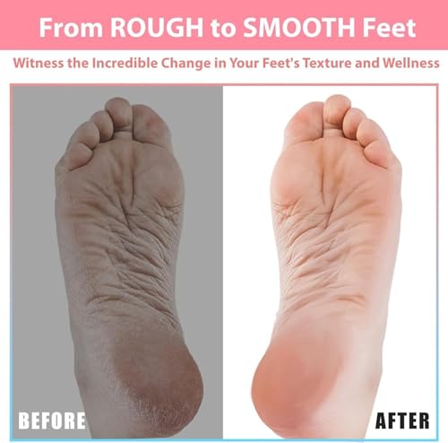 Efforest Shower Foot Scrubber Mat with Pumice Stone - Cleans, Smooths & Removes Dead Skin on Foot Without Bending, Foot Callus Remover with Non-Slip Suction Cups, Foot Scraper for Shower & Bathtub - color: Gray