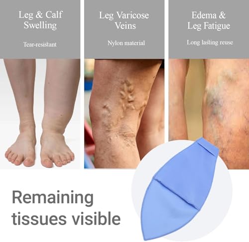 Open Toe Compression Sock Aid for Easy Slide - Slip Stocking Applicator to Help Assist Put On for Elderly, Disabled, Pregnant, 2 Pcs (Blue) - size: 2 Pcs (Blue)