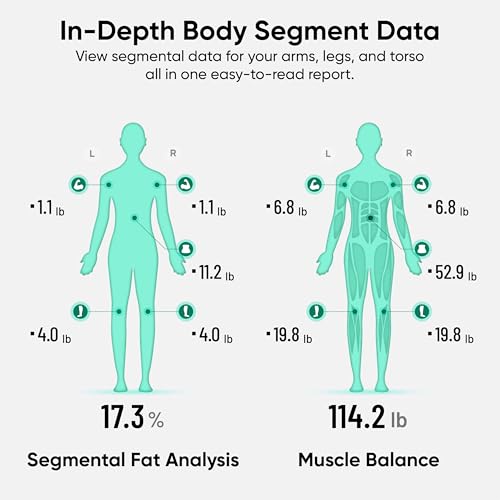 Wyze Smart Scale Ultra BodyScan with Handle – Wi-Fi & Bluetooth Body Composition Scale for Weight, BMI, Body Fat, Muscle Mass, and Segmental Measurement, 400 lbs, White - color: White, size: 13.39 in x 15.43 in x 2.13 in
