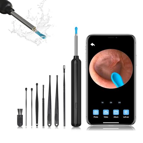 Ear Wax Removal, Ear Wax Removal Tool Camera Built-in 1080P HD Otoscope Camera, with 8 Pcs Ear Set, Easy and Safe Ear Cleaning, for iPhone, iPad & Android, Ear Cleaner Earwax Removal Kit (Black-New) - color: Black-New