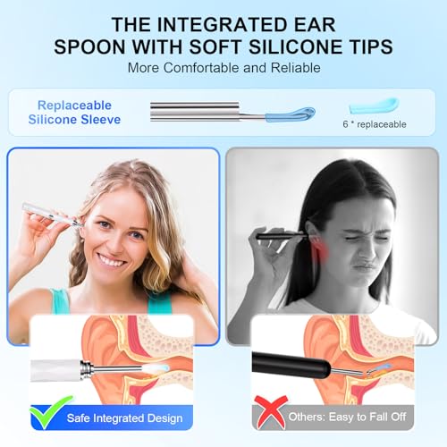 High-Definition Ear Wax Removal, Wireless Ear Cleaner, Safe and Gentle Ear Wax Removal Kit, Rechargeable Ear Cleaner with Camera and Light, Ear Cleaning Kit for Android and iOS (White) - color: White