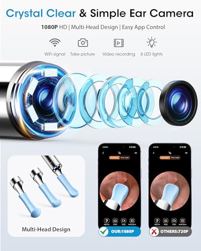 Ear Cleaner with Camera & Irrigation. Wax Removal & Overheat Protect | Complete Ear Cleaning Kit, Visual, Waste Collection Tank, Overheat Auto-Shutoff, IPX7 Waterproof, FSA-HSA Ear Wax Removal - color: Semi-transparent Black