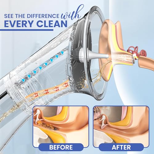 Electric Ear Cleaner - Ear Wax Removal Kit - LED Display - Water Powered Ear Irrigation System - IPX7 Waterproof - Easy to Use