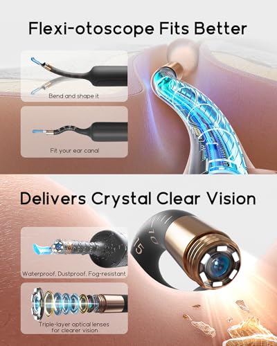 Bebird Earsight Plus R37R Ear Wax Removal Tool Camera, FSA HSA Eligible Items, Smart Ear Cleaner with Painless Visual Tweezers, Flexible Ear Camera Otoscope, Home ENT Cleaning Kit for Family,Black - color: Black