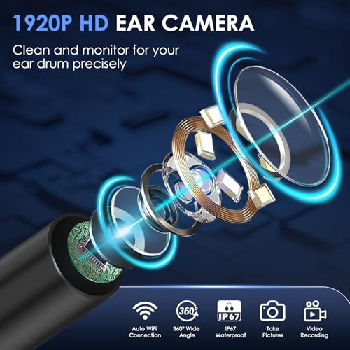 Xylla Ear Wax Removal Kit WiFi Ear Cleaner 1920P FHD Ear Camera,Ear wax remover with 8 PCS Ear Cleaning Kit,Ear Scope Otoscope with 6 LED Lights,Silicone Ear Wax Removal Tool for iOS & Android (Black) - color: Black