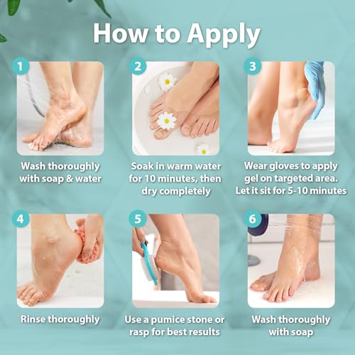 Ebanel Salon Grade Callus Remover for Feet with 20% Urea, Pedicure Gel Peel | with Salicylic Acid, Glycolic Acid, Epsom Salt, Heel Toe Foot Callus and Dead Skin Remover Gel for Feet, Cracked Heel Repair - size: 8.5 Ounce (Pack of 1)