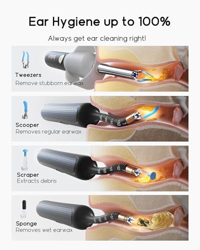 Bebird Earsight Plus R37R Ear Wax Removal Tool Camera, FSA HSA Eligible Items, Smart Ear Cleaner with Painless Visual Tweezers, Flexible Ear Camera Otoscope, Home ENT Cleaning Kit for Family,Black - color: Black