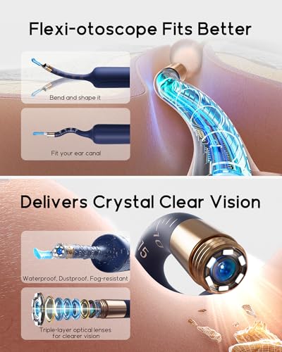 Bebird Earsight Plus R37R Ear Wax Removal Tool Camera, FSA HSA Eligible Items, Smart Ear Cleaner with Painless Visual Tweezers, Flexible Ear Camera Otoscope, Home ENT Cleaning Kit for Family,Blue - color: Blue