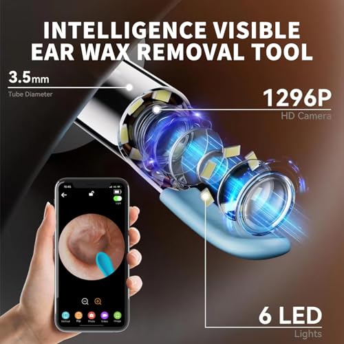 Ear Wax Removal Tool Kit, Ear Cleaner Earwax Removal Kit with Camera and Light, Ear Wax Cleaner with 1080P Ear Camera for iOS & Android(White) - color: Ear Wax Removal White