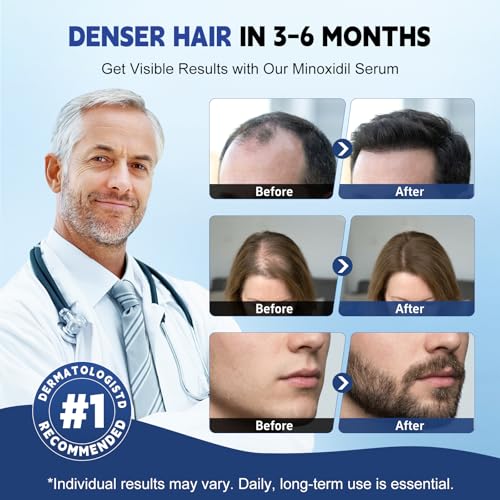 8 Pack 5% Minoxidil Hair Growth Treatment for Men and Women, Extra Strength Minoxidil Liquid Solution for Thicker, Fuller Hair, Beard Growth Serum, Biotin & Castor Oil Enriched,8 Month Supply