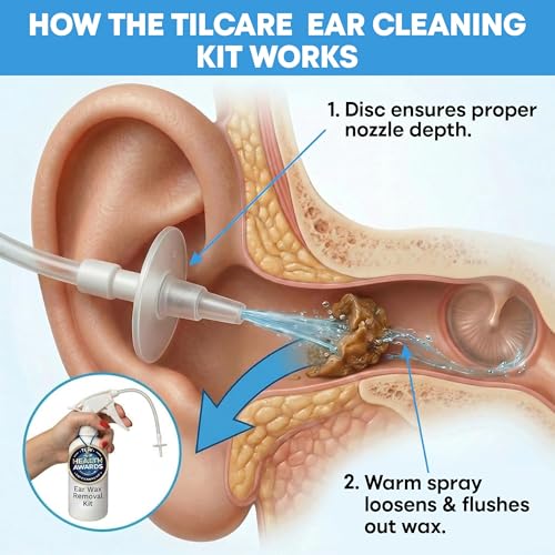 Ear Wax Removal Tool by Tilcare - Ear Irrigation Flushing System for Adults & Kids - Perfect Ear Cleaning Kit - Includes Basin, Syringe, Curette Kit, Towel and 30 Disposable Tips | Water Flush- Based Ear Cleaning Kit for Adults, Teens and Children | Inclu