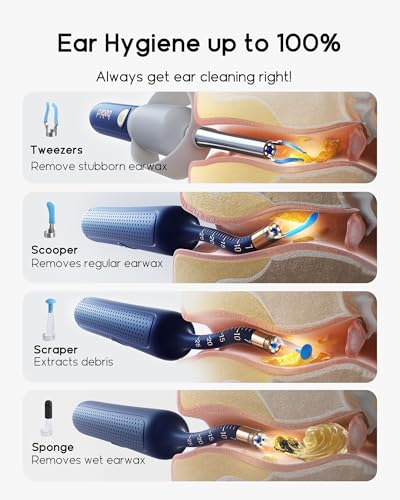 Bebird Earsight Plus R37R Ear Wax Removal Tool Camera, FSA HSA Eligible Items, Smart Ear Cleaner with Painless Visual Tweezers, Flexible Ear Camera Otoscope, Home ENT Cleaning Kit for Family,Blue - color: Blue