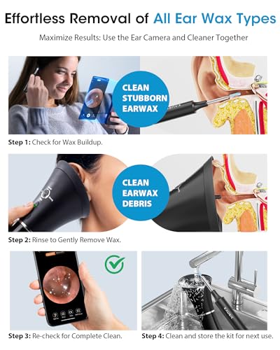 Ear Cleaner with Camera & Irrigation. Wax Removal & Overheat Protect | Complete Ear Cleaning Kit, Visual, Waste Collection Tank, Overheat Auto-Shutoff, IPX7 Waterproof, FSA-HSA Ear Wax Removal - color: Jet Black