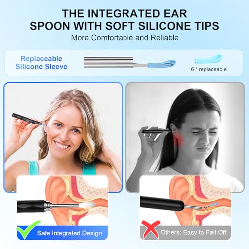 High-Definition Ear Wax Removal, Wireless Ear Cleaner, Safe and Gentle Ear Wax Removal Kit, Rechargeable Ear Cleaner with Camera and Light, Ear Cleaning Kit for Android and iOS (Black) - color: Black